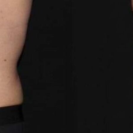 EM-Slim Behandlung mit Magnetwellen zum Traumfigur bei Swisskin Clinic AG