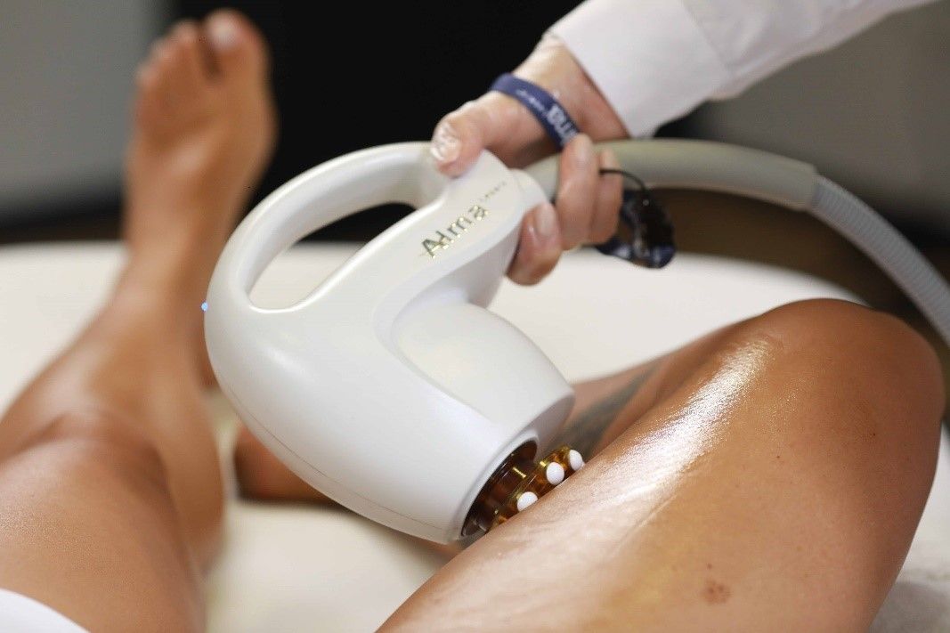 Thermolift Accent Prime bei Swisskin Clinic AG